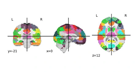 Emotional Artificial Intelligence